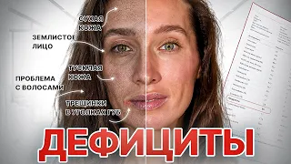 Из-за этого лицо СТАРЕЕТ БЫСТРЕЕ | О чем говорит тусклая, сухая кожа и заеды на губах?