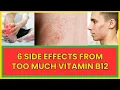 Side Effects from too much Vitamin B12