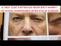He Looked Like Clint Eastwood in Dirty Harry The Scowl Disappeared after Blepharoplasty Surgery