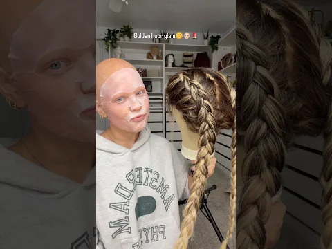 Dutch braids to messy bun👩🏻‍🦲💄🌞 #alopecia