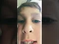 Yellow hearts Turns to Butt cheeks jiggle when I fart