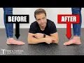 Download Lagu How To Fix Flat Feet With Exercises At Home