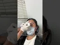 Lagu SQUEEZING MY EYELID PIMPLES (ilux treatment for dry eyes)