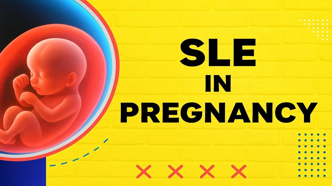 SLE in Pregnancy | Maternal and Fetal Complications of Systemic LUPUS Erythematosus | TOG Article