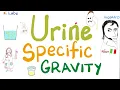 Urine specific gravity - Density