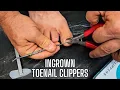 Toenail Clippers for Ingrown Thick Toenails