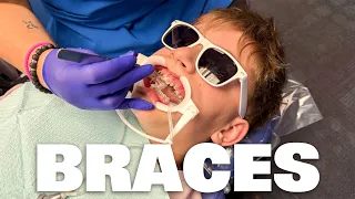 GETTING BRACES FOR THE FIRST TIME!