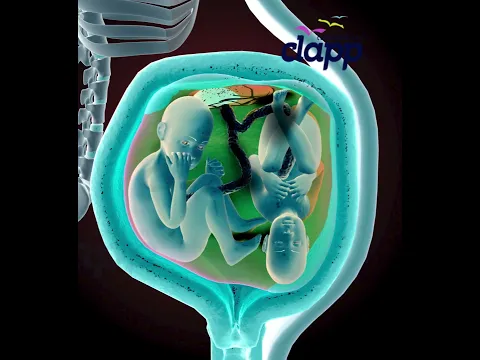 Twins fight Inside the Womb! ❤️ Pregnancy Animation