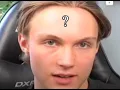 Joen world record holder for the biggest forehead