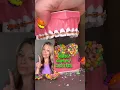 Download Lagu BEST AND WORST HALLOWEEN CANDIES FOR BRACES / TEETH 🎃👻🦷