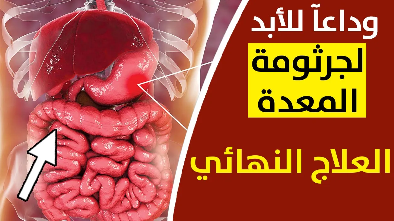 ما هي أسباب وأعراض جرثومة المعدة ؟ اطعمة تنظف المعدة وسيقضي على اعرض جرثومة المعدة نهائي