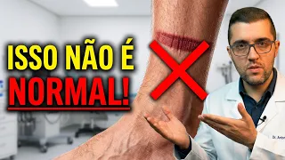 Por que a Marca da Meia Demora para Sumir? Cirurgião Vascular Explica os 5 Sinais de Alerta