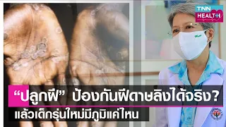 อาการของโรคฝีดาษลิงมีอะไรบ้าง และจะดำเนินไปอย่างไรในร่างกาย