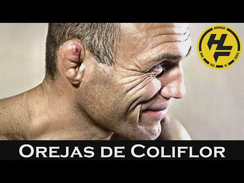 Download MP3 OREJAS de COLIFLOR💉👂 [Causas - Prevención - Tratamiento]