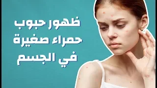 ظهور حبوب حمراء صغيرة في الجسم موضوع 