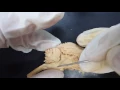 4 Median Sagittal of the Brain 3