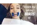 Download Watch me get my Braces off!!! mp4 3gp mp3 videos - waplic