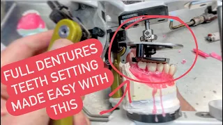 HOW TO SET DENTURE TEETH with the 3D setup template