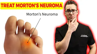 Download How To Treat Morton's Neuroma \u0026 Foot Injection Research [2021] MP3