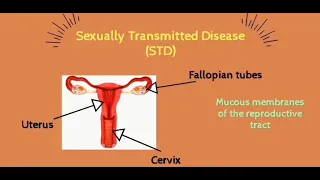 gonorrhea genital tract infection 