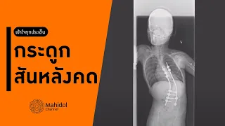 การผ่าตัดกระดูกสันหลังในเด็กที่มีสมองพิการมีจุดประสงค์อย่างไร
