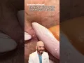 Removing a year old pimple patch credit delarouxskincare on TT