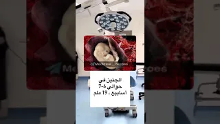 الجنين في الاسبوع السابع 