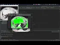 Stanford CS106A Code in Place Final Project - Detecting pneumonia