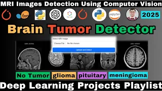 Building a Brain Tumor Detection Using Deep Learning MRI Images Detection Using Computer Vision