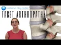 Natalie Explains Facet Arthropathy