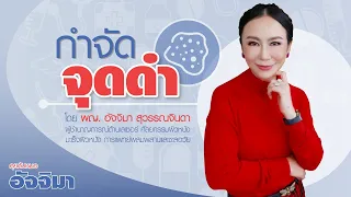 จุดดำบนใบหน้าเกิดจากอะไรบ้าง