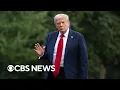 Download Lagu Details on Trump's chronic venous insufficiency diagnosis