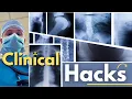How to Survive and Thrive in X-Ray Clinicals