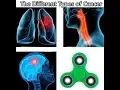 Youtube s fidget spinner easter egg
