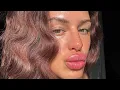 Come with me to get Botox