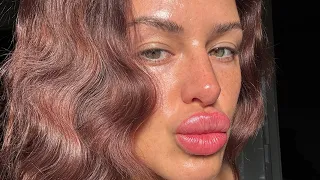 Come with me to get Botox