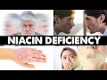 Strange Weird Niacin B3 Deficiency Signs and Symptoms