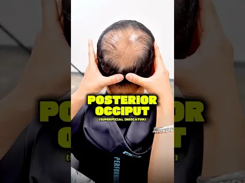 POSTERIOR OCCIPUT (SUPERFICIAL INDICATOR) ‼️🧐  #chiropractic #backpain #neckpain #trending