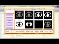 Matlab Code for Lung Cancer Detection and Classification Full Source Code