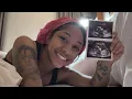 Big Jadaa Tell Us How She Got Pregnant by Lil Noonie