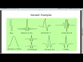 Lecture 1 9 Wavelet Transform
