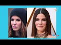 Sandra Bullock and Cheek Fillers