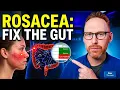 Rosacea Won t Go Away Your Digestion Might Be the Problem