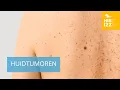 Download Lagu Huidtumoren: interview met Dr. Jérôme Duisit