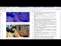 ieee projects on image processing using matlab