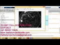 Matlab code for Retinal Image Quality Analysis for Automatic Diabetic Retinopathy Detection