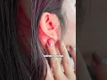 Download Lagu Kenapa migrain sering kambuh, padahal sudah tidur cukup dan minum obat? Jawabannya mungkin lebi