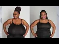 Massive breast reduction performed by Houston surgeon