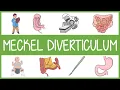 Download Lagu Meckel's Diverticulum Mnemonic