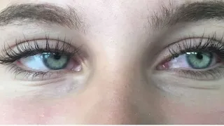 انفجار فجوه العيون الخضراء 